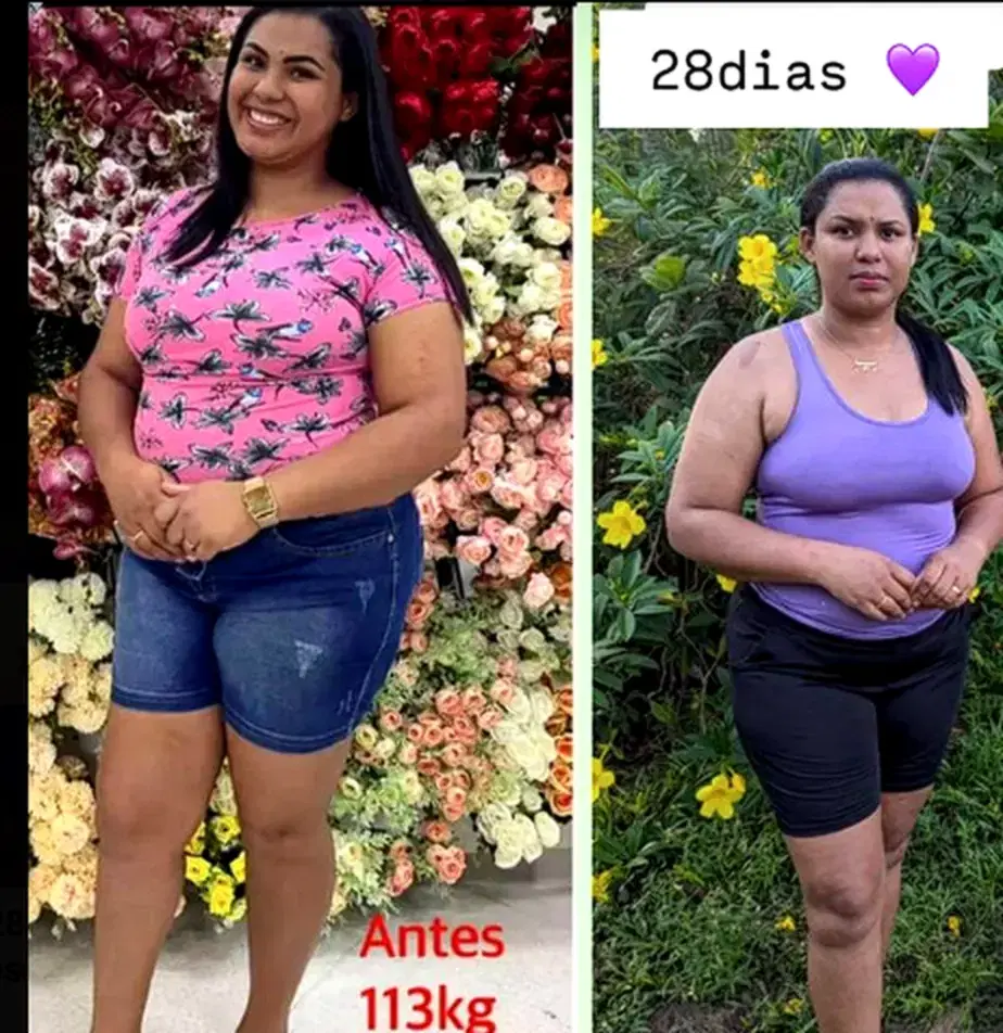 28 dias de tratamento, antes e depois